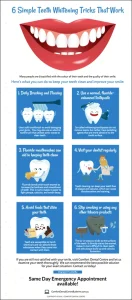image of teeth whitening